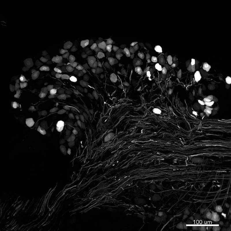 Dorsal root ganglion neurons highlighting GFP expression.