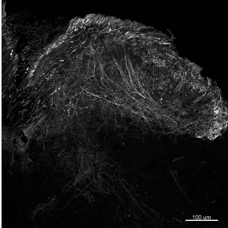 Dorsal horn neurons labeled with fluorescent proteins.