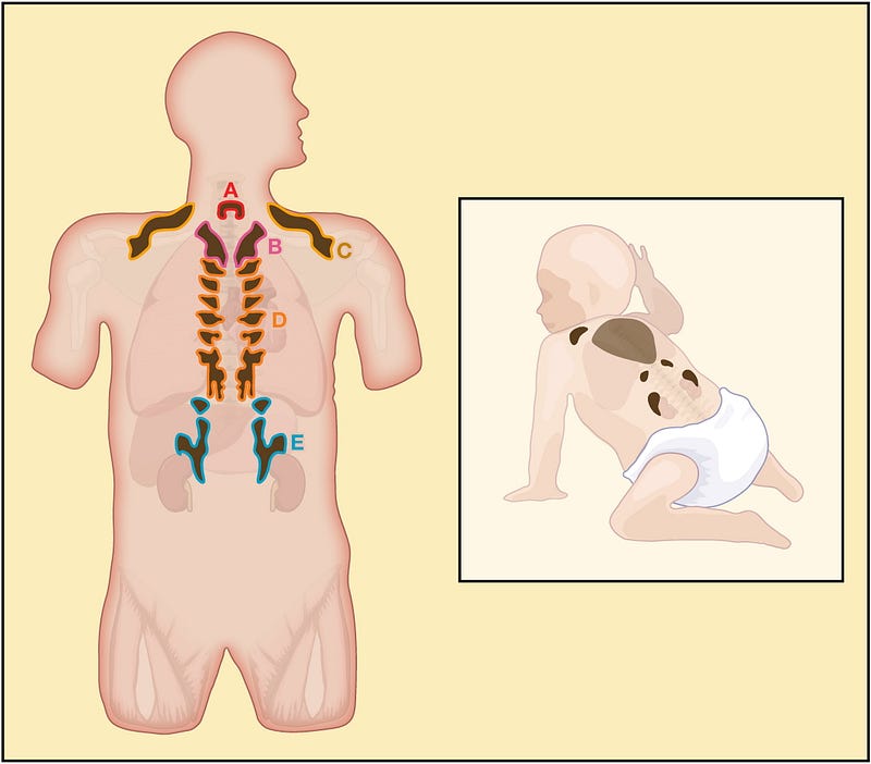 Brown adipose tissue's role in infant warmth