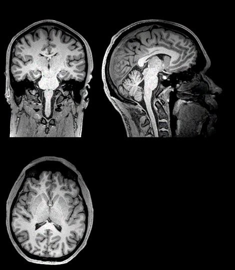 Anatomical brain image viewed from three axes