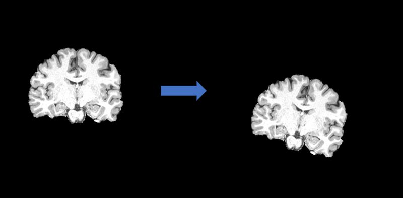 Example of a rigid body transformation